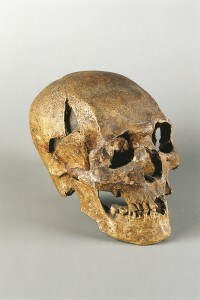 Teschio di Homo sapiens