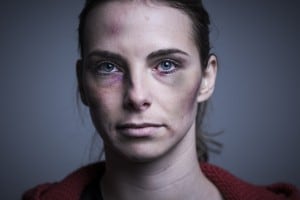 La violenza sulle donne porta danni fisici e psicologici