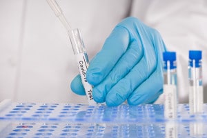 Test sierologico a campione